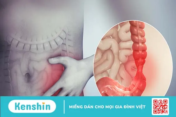 Nhiễm Giardia (nhiễm trùng ruột non do Giardia)