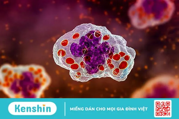 Những thói quen sinh hoạt nào giúp bạn hạn chế diễn tiến của nhiễm nấm Histoplasma (vi nấm Histoplasma)?