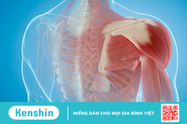 Rách cơ và những dấu hiệu không nên xem nhẹ