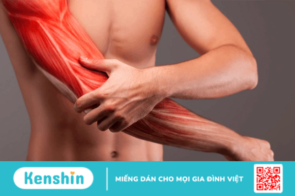 Rách cơ và những dấu hiệu không nên xem nhẹ