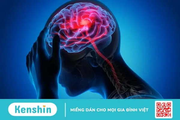 Rối loạn tuần hoàn não