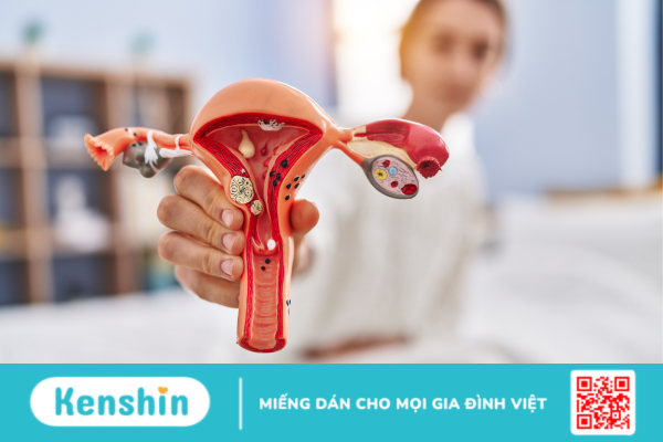 Tắc ống dẫn trứng có nguy hiểm không? Nguyên nhân và phương pháp điều trị