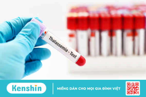 Những dấu hiệu và triệu chứng của bệnh thalassemia là gì?