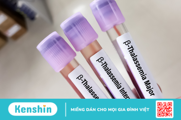 Thalassemia - Những hiều biết cơ bản về bệnh tan máu bẩm sinh