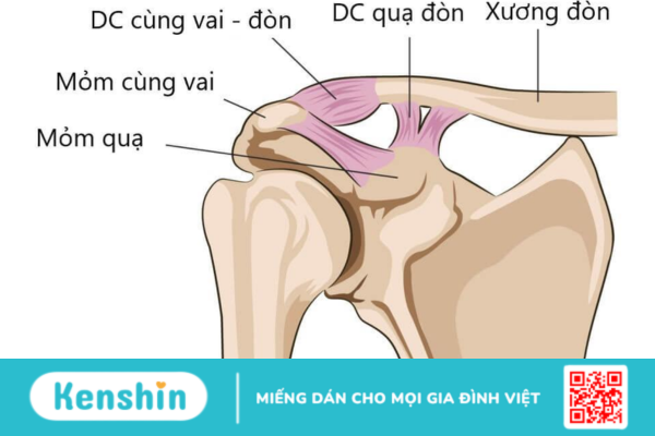 Phương pháp điều trị trật khớp cùng đòn hiệu quả