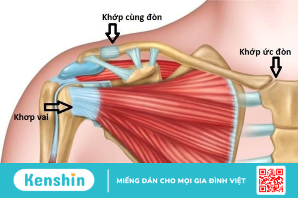 Phương pháp điều trị trật khớp cùng đòn hiệu quả