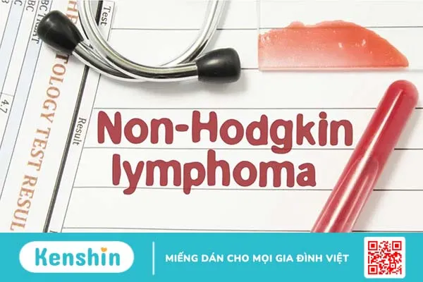 U lympho không Hodgkin (Ung thư hạch không Hodgkin)