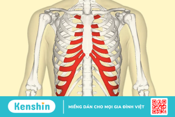 Viêm sụn sườn và những điều người bệnh cần biết!