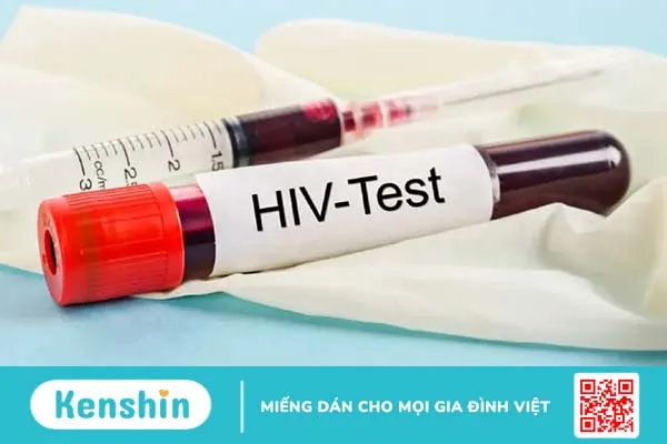 Xét nghiệm HIV