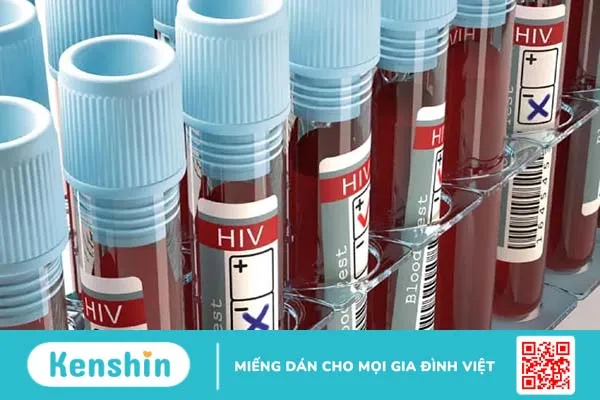 Xét nghiệm HIV