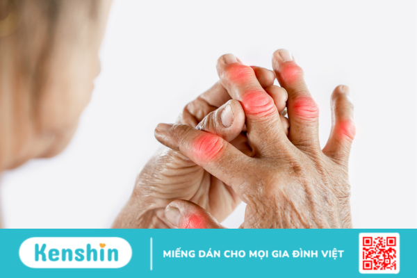 Những triệu chứng nhận biết xơ khớp và phương pháp điều trị hiệu quả