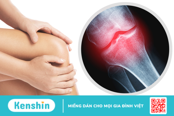 Những triệu chứng nhận biết xơ khớp và phương pháp điều trị hiệu quả